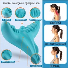 Boyun Hörgücü ve Kamburluk Önleyen Ortopedik Yastık | Dik Duruş, Sağlıklı Omurga ve Rahat U