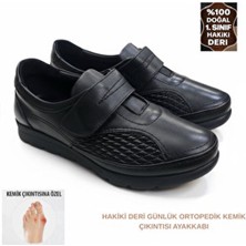 Shougo Tam Ortopedik Hakiki Deri Çift Taraflı Halluks Valgus Kemik Çıkıntısı Anne Ayakkabısı