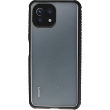 Eco Port Xiaomi Mi 11 Lite Kılıf Miami Şeffaf Silikon - Siyah