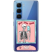 TechTree Infinix Hot 60-60I Uyumlu You Look Good Iskelet Tasarımlı Baskılı Silikon Kılıf