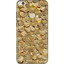 Senada Huawei P9 Lite 2017 Kılıf Desenli Baskılı Tpu Rubber Kapak Gold Yaprak