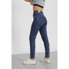 Neva Shop Lazer Detaylı Mom Jeans