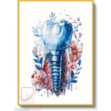 Tablonhazır Dikey Çerçeveli Cam Klinik Implant Modern Ev Dekoru Duvar Sanatı Ev Ofis Tablosu