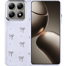 Ankayan Teknoloji 14T Kılıf Airbag Tasarımlı Simli Şeffaf Anky Kutup Kapak - Fiyonk