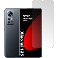 Smart Tech Xiaomi Redmi 12S Uyumlu Nano Cam Ekran Koruyucu