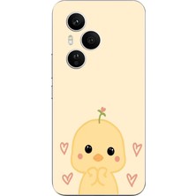 TechTree Honor 400 Pro Uyumlu Sevimli Civciv ve Kalp Desenli Baskılı Silikon Kılıf