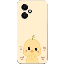 TechTree Honor 400 Uyumlu Sevimli Civciv ve Kalp Desenli Baskılı Silikon Kılıf