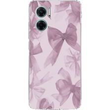 TechTree Redmi Note 11E Uyumlu Menekşe Tonlu Fiyonk Baskılı Silikon Kılıf