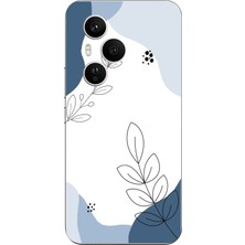 TechTree Honor 400 Pro Uyumlu Mavi Huzur Şekiller ve Botanik Çizgiler Baskılı Silikon Kılıf