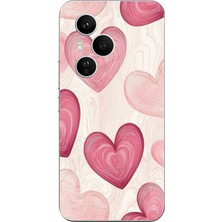 TechTree Honor 400 Pro Uyumlu Çizgisel Pembe Kalp Baskılı Silikon Kılıf