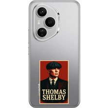 TechTree Honor 400 Pro Uyumlu Thomas Shelby Afiş Baskılı Silikon Kılıf