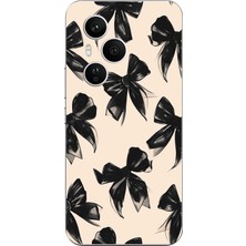 TechTree Honor 400 Pro Uyumlu Siyah Fiyonk Kurdele Baskılı Silikon Kılıf