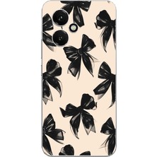 TechTree Honor 400 Uyumlu Siyah Fiyonk Kurdele Baskılı Silikon Kılıf