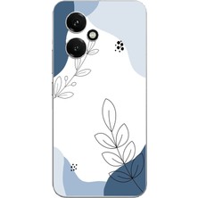 TechTree Honor 400 Uyumlu Mavi Huzur Şekiller ve Botanik Çizgiler Baskılı Silikon Kılıf