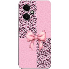 TechTree Honor 400 Uyumlu Pembe Leopar Desenli ve Kurdele Baskılı Silikon Kılıf