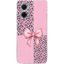 TechTree Redmi Note 11E Uyumlu Pembe Leopar Desenli ve Kurdele Baskılı Silikon Kılıf