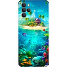 Grabono Omix X700 Kılıf Hd Silikon Renkli Temalı Desenli Tpu Island