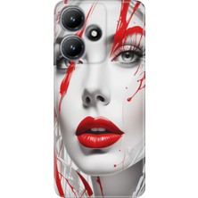 Grabono Infinix Hot 30 Kılıf Baskılı Esnek Silikon Kapak Lady