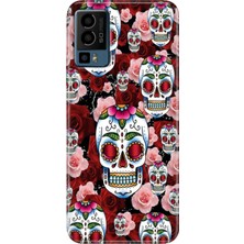 Grabono General Mobile Gm 23 Kılıf Desenli Baskı Tpu Silikon Uv Kabile