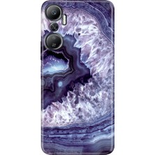 Grabono Infinix Hot 20 Kılıf (X6826C) Desenli Baskılı Esnek Silikon Kapak Elmas