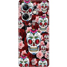 Grabono Infınıx Zero 30 4g Kılıf Renkli Desenli Baskı Silikon Kabile