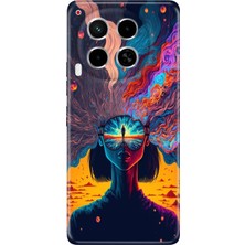 Grabono Tecno Camon 30 Kılıf (Cl6) Uyumlu Silikon Desenli Kapak Girdap