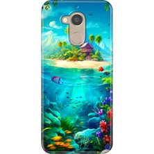 Grabono General Mobile Gm 8 Uyumlu Kılıf Desenli Silikon Renkli Tpu Uv Island