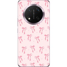TechTree Honor Magic 7 Lite Uyumlu Soft Pembe Fiyonk Desenli Baskılı Silikon Kılıf