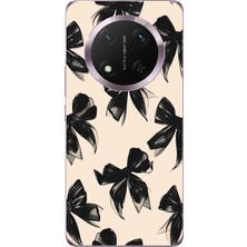 TechTree Honor Magic 7 Lite Uyumlu Siyah Fiyonk Kurdele Baskılı Silikon Kılıf