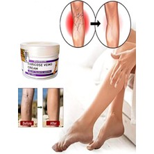 Süper Varicose And Spider Veins Soothing Leg Cream Bacak Bakım Kremi 100 ml