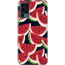 Grabono General Mobile Gm 23 Kılıf Desenli Baskı Tpu Silikon Uv Karpuz
