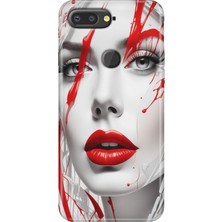 Grabono General Mobile Gm 9 Pro Kılıf Desenli Esnek Silikon Kapak Uv Lady