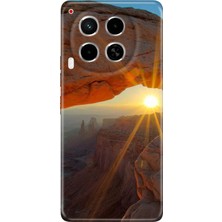 Grabono Tecno Camon 30 Kılıf (Cl6) Uyumlu Silikon Desenli Kapak Sun