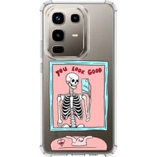 TechTree Infinix Note 50 Pro Uyumlu You Look Good Iskelet Tasarımlı Baskılı Silikon Kılıf