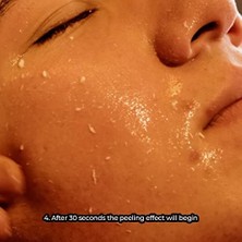 Totex Yüz Peeling ve Ovma Jeli | Yüz Bakımı Ginseng Parlatıcı Peeling Siyah Noktaları Temizler | Koyu Nokta Akne Için Hızlı Etki 125 ml