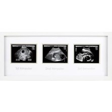87038 Trimester Sonogram Frame Deluxe, Fotoğraf Çerçevesi Için Üç Ultraschallaufnahmen, Beyaz