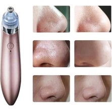 TeknoKapsül Siyah Nokta Cihazı - TK0027-5U5TQ3