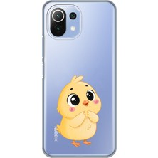 Manitoba Xiaomi Mi 11 Lite Uyumlu Baskılı Yumuşak Silikon Şeffaf Telefon Kılıfı