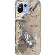 Manitoba Xiaomi Mi 11 Lite Uyumlu Baskılı Yumuşak Silikon Şeffaf Telefon Kılıfı