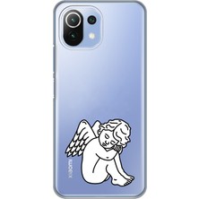 Manitoba Xiaomi Mi 11 Lite Uyumlu Baskılı Yumuşak Silikon Şeffaf Telefon Kılıfı