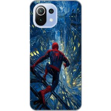 Manitoba Xiaomi Mi 11 Lite Uyumlu Baskılı Yumuşak Silikon Şeffaf Telefon Kılıfı