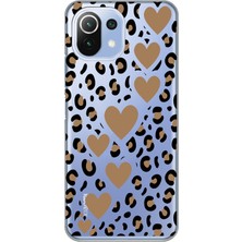 Manitoba Xiaomi Mi 11 Lite Uyumlu Baskılı Yumuşak Silikon Şeffaf Telefon Kılıfı