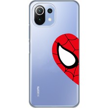 Manitoba Xiaomi Mi 11 Lite Uyumlu Baskılı Yumuşak Silikon Şeffaf Telefon Kılıfı