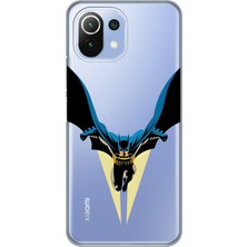 Manitoba Xiaomi Mi 11 Lite Uyumlu Baskılı Yumuşak Silikon Şeffaf Telefon Kılıfı