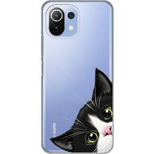 Manitoba Xiaomi Mi 11 Lite Uyumlu Baskılı Yumuşak Silikon Şeffaf Telefon Kılıfı