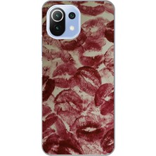 Manitoba Xiaomi Mi 11 Lite Uyumlu Baskılı Yumuşak Silikon Şeffaf Telefon Kılıfı