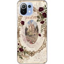 Manitoba Xiaomi Mi 11 Lite Uyumlu Baskılı Yumuşak Silikon Şeffaf Telefon Kılıfı