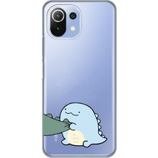 Manitoba Xiaomi Mi 11 Lite Uyumlu Baskılı Yumuşak Silikon Şeffaf Telefon Kılıfı