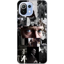 Manitoba Xiaomi Mi 11 Lite Uyumlu Baskılı Yumuşak Silikon Şeffaf Telefon Kılıfı