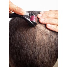 Sevimle Store Uçlu Saç Sakal Çıkarma Tarağı Iğneli Cilt Yenileyici Gözenek Açıcı Dermaroller 0,75MM